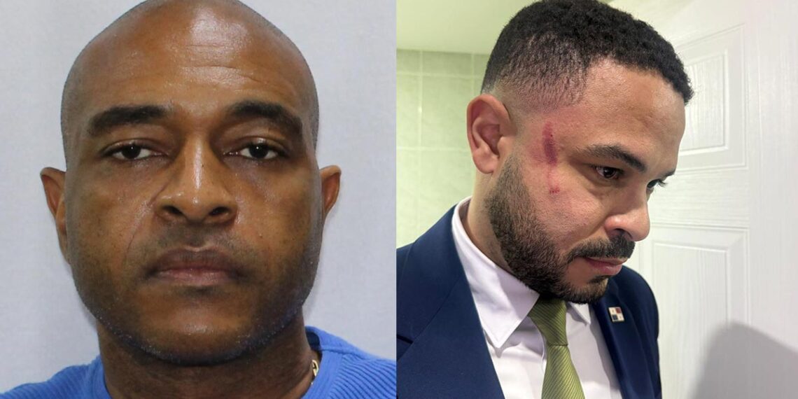 Pelea entre Betserai Richards y Jairo 'Bolota' Salazar - tupolitica.com